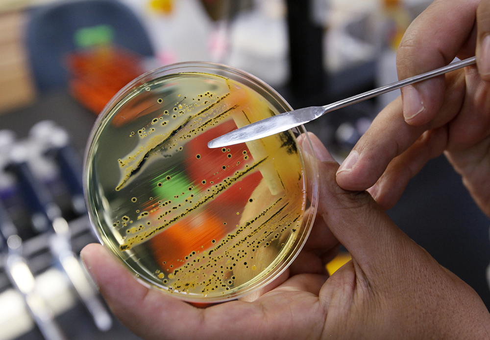 Dr. Mansour Samadpour points out a growth of salmonella in a petri dish at IEH Laboratories in Lake Forest Park, Wash. The World Health Organization has issued a list of the top dozen bacteria most dangerous to humans, warning that doctors are fast running out of treatment options. (AP Photo/Elaine Thompson, file)